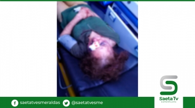 Una mujer desfigurada durante secuestro exprés en Guayaquil