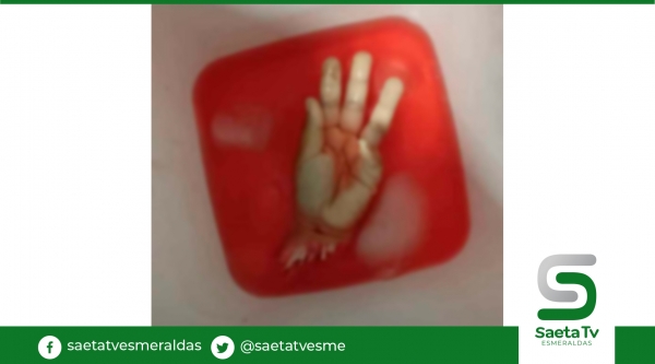 Su pareja le mutiló una mano