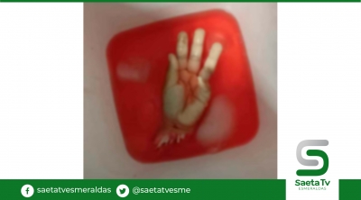 Su pareja le mutiló una mano